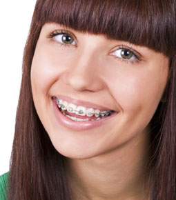 What is the Cost of Braces in Columbus, OH?